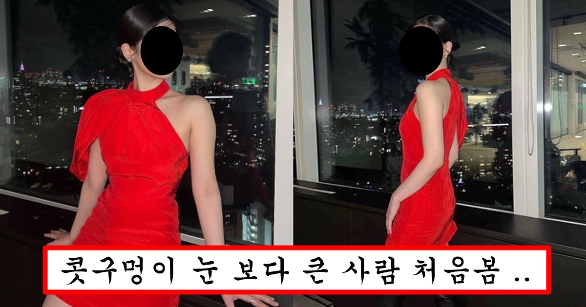 원래 예뻤는데 콧구멍 평수 확장돼서 코 수술 시급해 보인다는 아이돌